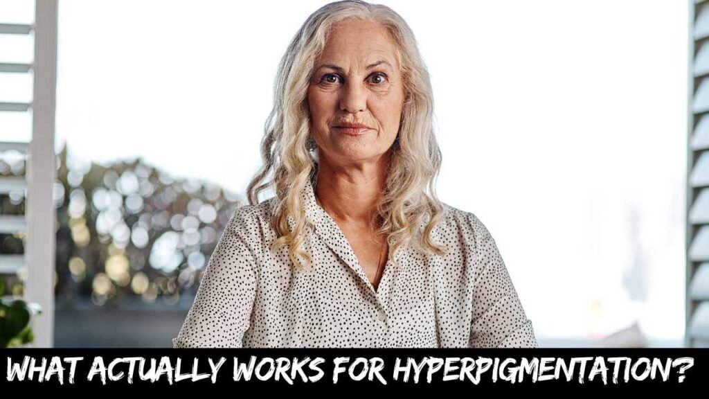 What actually works for hyperpigmentation?